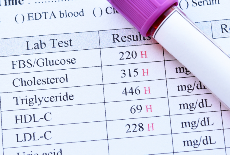 Blutwerte zur Schilddrüsenunterfunktion mit hohen Cholesterin- und Triglyceridwerten.