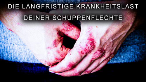 Der PeakPASI ist sehr relevant bei Psoriasis
