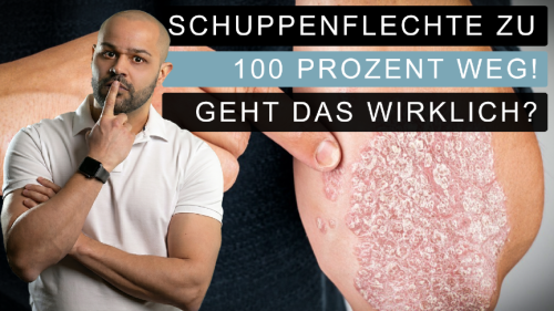 Schuppenflechte kann vollständig verschwinden 