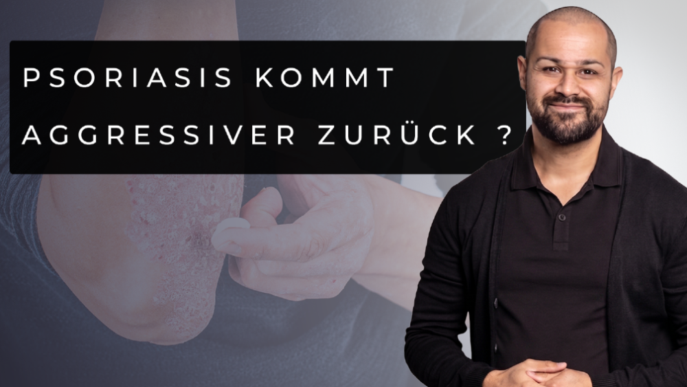 Mann erklärt, wie man den Psoriasis-Teufelskreis durchbrechen kann.