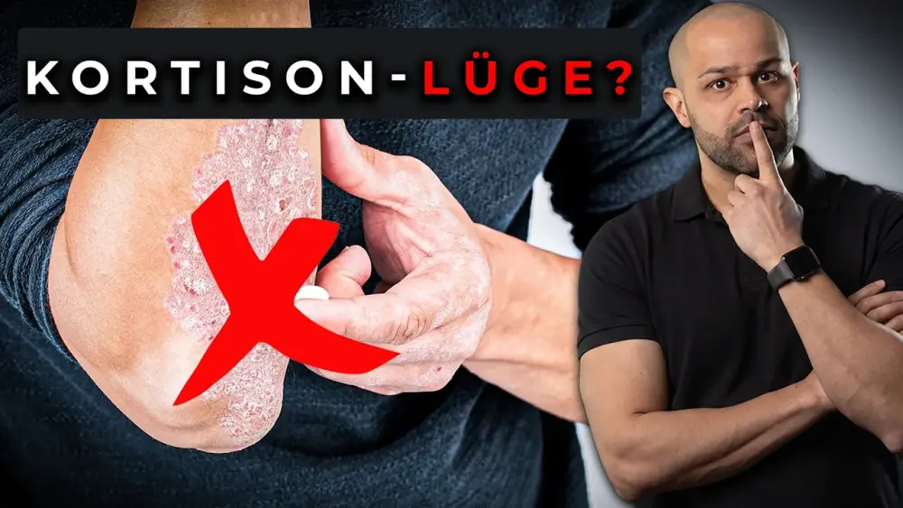Mann zeigt auf Haut mit Schuppenflechte und stellt die Kortison-Lüge in Frage.