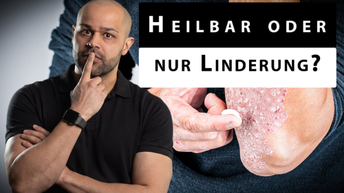 Ist Psoriasis heilbar oder leider nur behandelbar?