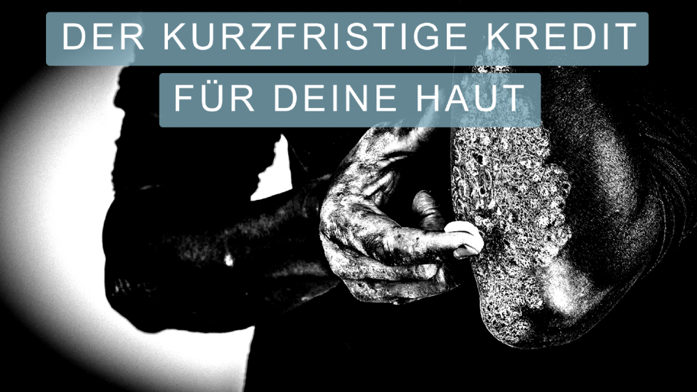 Kortison schafft kurzfristige Abhilfe und langfristigen Probleme