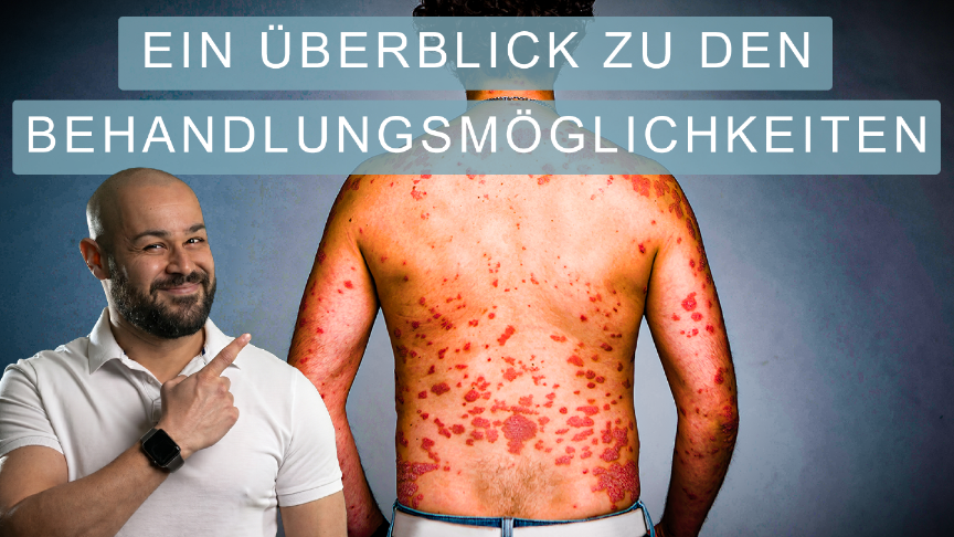Eine Übersicht zu allen Behandlungsmöglichkeiten deiner Psoriasis