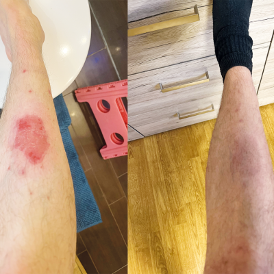 Von Abweisung zur Biologika-Therapie in Wochen: Struktur, Darmtest und überzeugende Kommunikation