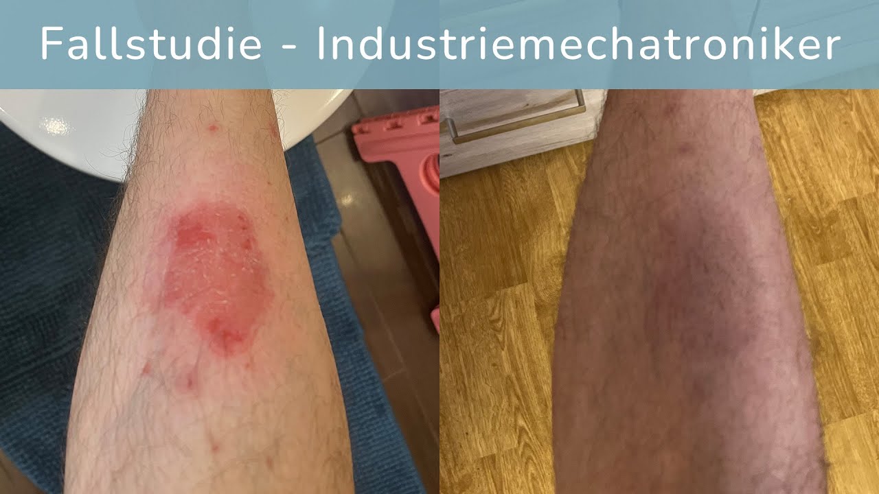Bild #1 von 2