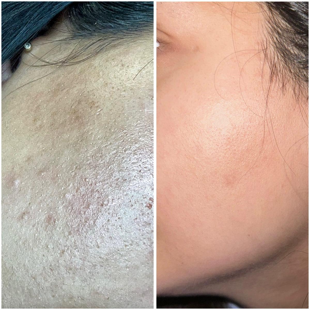 Der Viking Skincareguide + die individuelle Anpassung der Skincare sind insane.