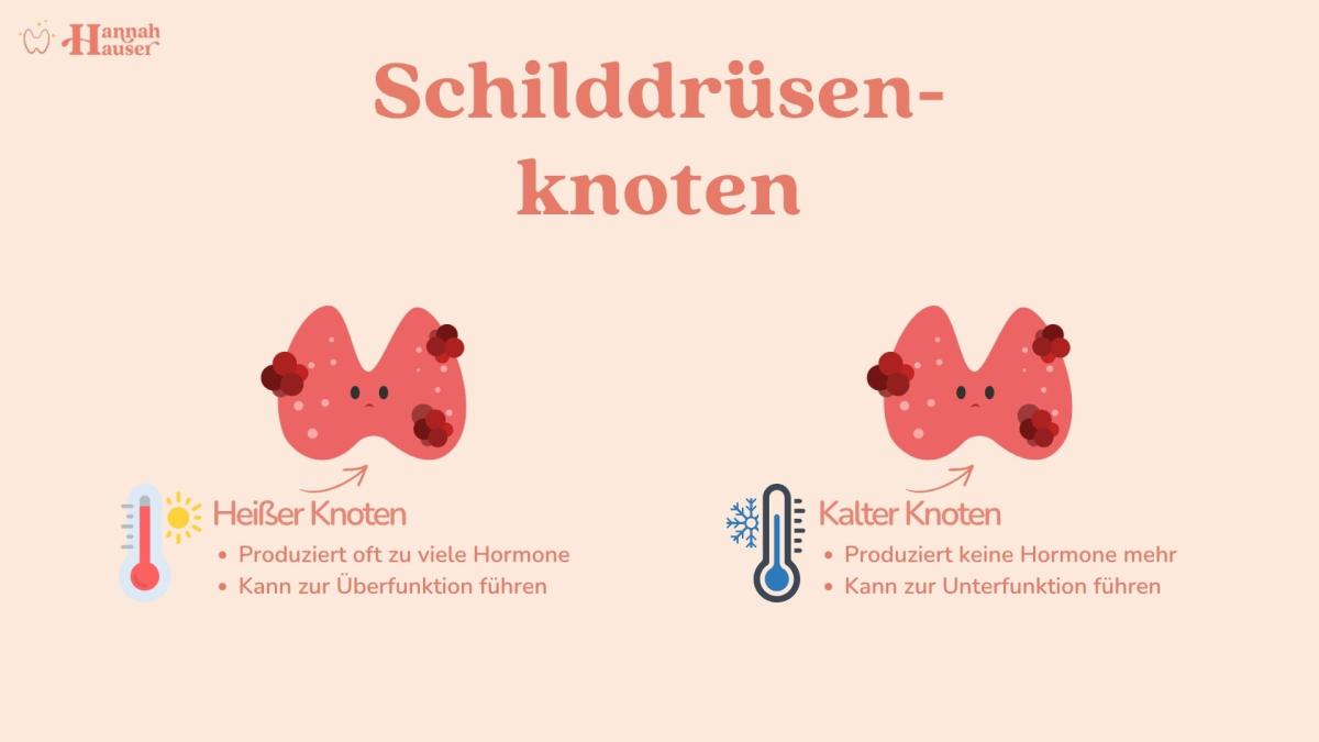 In der Medizin wird zwischen heißen und kalten Schilddrüsenknoten unterschieden. Hierbei geht es nicht um die Temperatur, sondern um die Aktivität der Schilddrüse.
