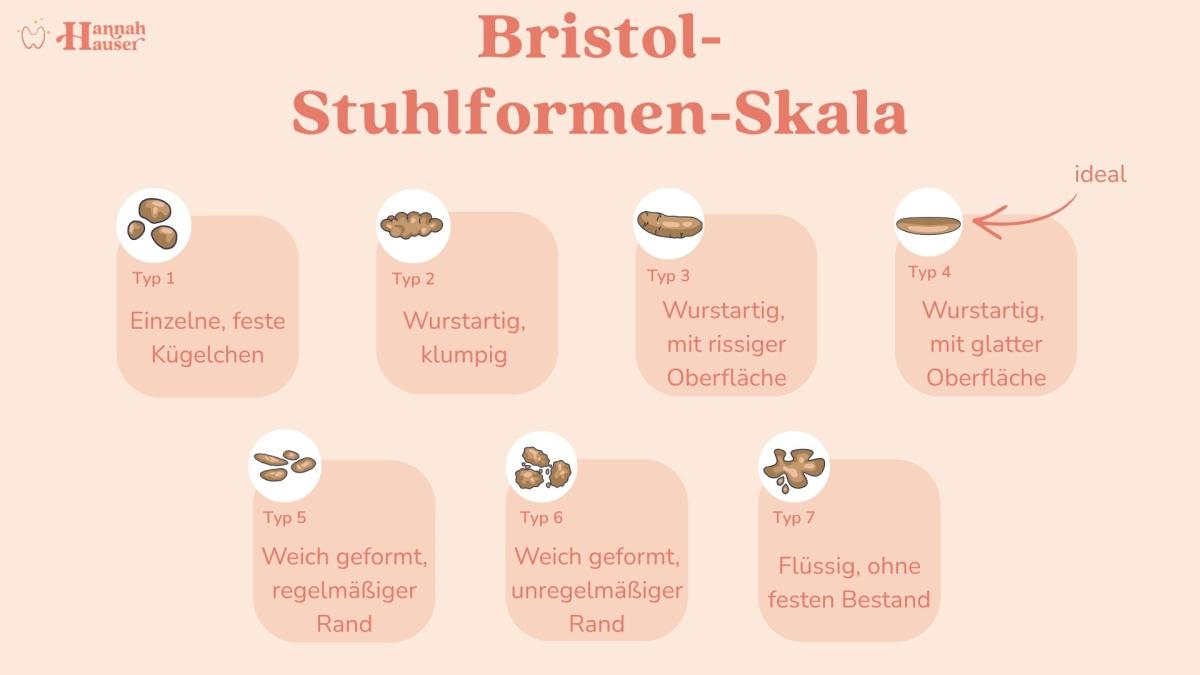 Mit der Bristol-Stuhlformen-Skala lassen sich Hinweise auf die Verdauungsgesundheit besser einschätzen