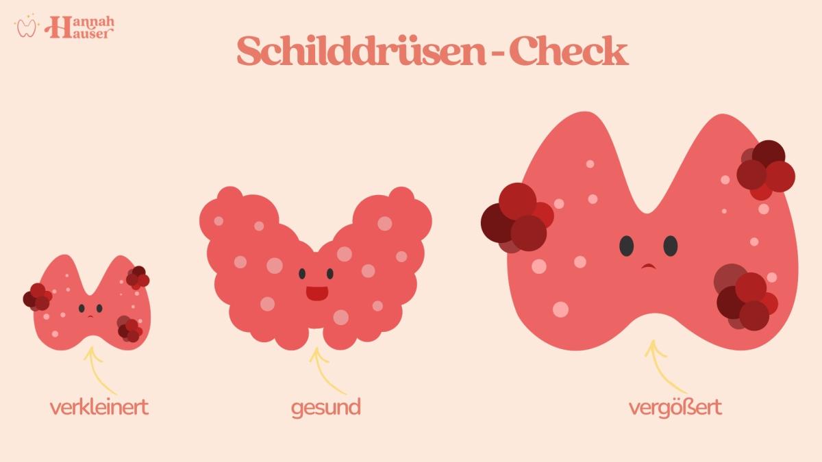 Deine Schilddrüse kann sich durch Hashimoto sowohl verkleinern als auch vergrößern