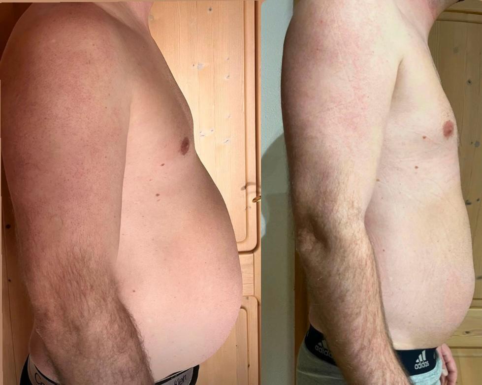 Vorher-Nachher Vergleich zur Bauchfett verlieren Transformation.
