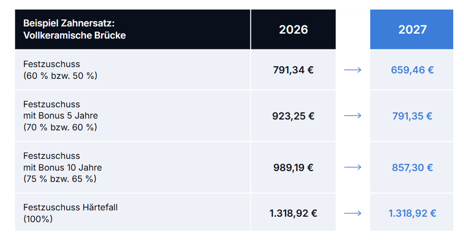 Kostenvergleich für Zahnersatz 2027 und 2028 im Rahmen der GKV-Reform 2027.
